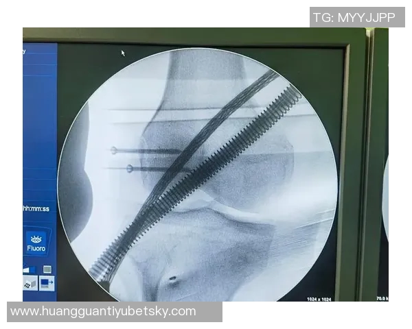 英博官方宣布宋岳成功接受关节镜微创手术恢复顺利无并发症